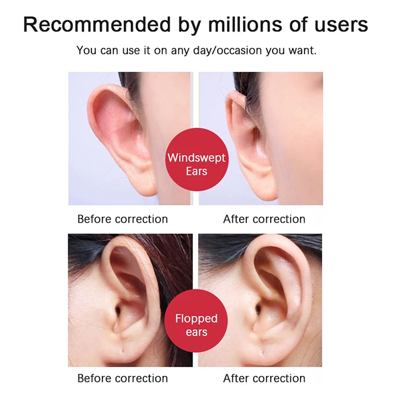 EAR CORRECTOR 2/4/6/8 PCS